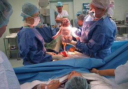 Obstetric Procedures