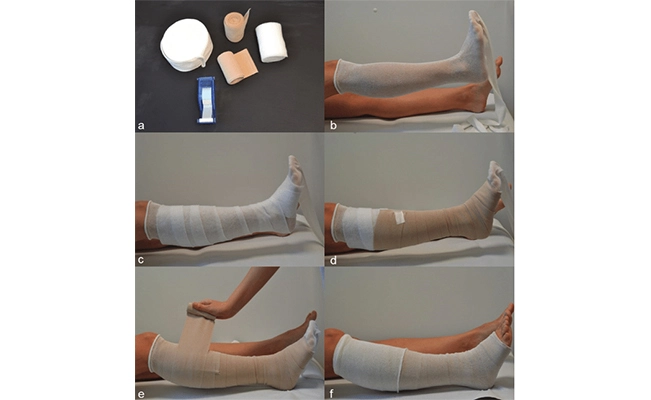 Custom Medical Crepe Bandages Manufacturer Elastic Bandage Supplier