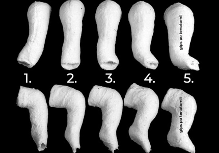 Corrective Casting