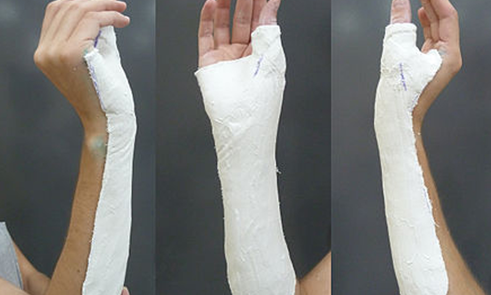 Features of POP Bandage
