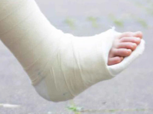 orthopaedic padding bandage3