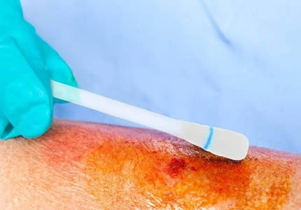 Wound cleaning