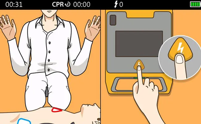 Press the Shock Button