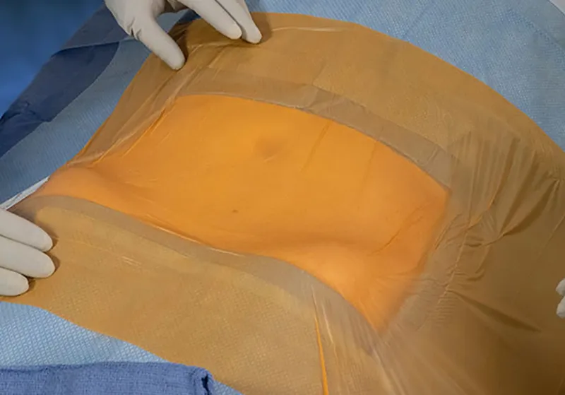 Surgical Application